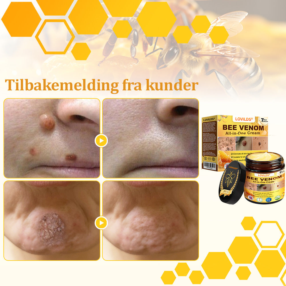 🐝LOVILDS® Strong Bee Venom Cream – Dermatologically tested and certified by dermatologists. Effective solution for stubborn warts, skin nodules, lesions, infections, and scars