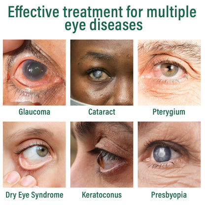 👩‍⚕️Bazenith™ Nano Eye Drops Serum ✅FDA Approved(Suitable for presbyopia, dry eye syndrome, glaucoma, and cataracts) 🌷