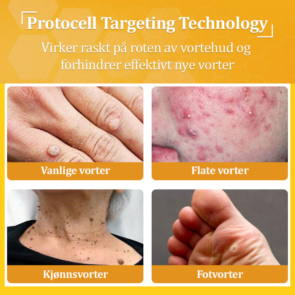 🐝LOVILDS® Strong Bee Venom Cream – Dermatologically tested and certified by dermatologists. Effective solution for stubborn warts, skin nodules, lesions, infections, and scars